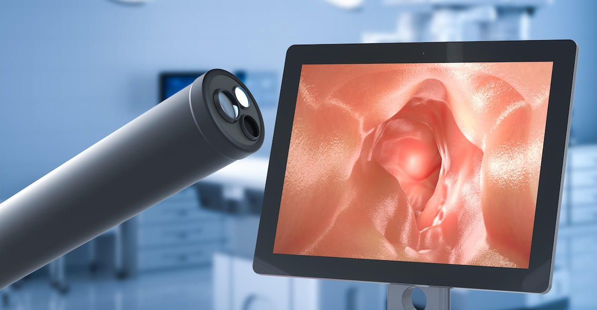 ЭГДС под наркозом