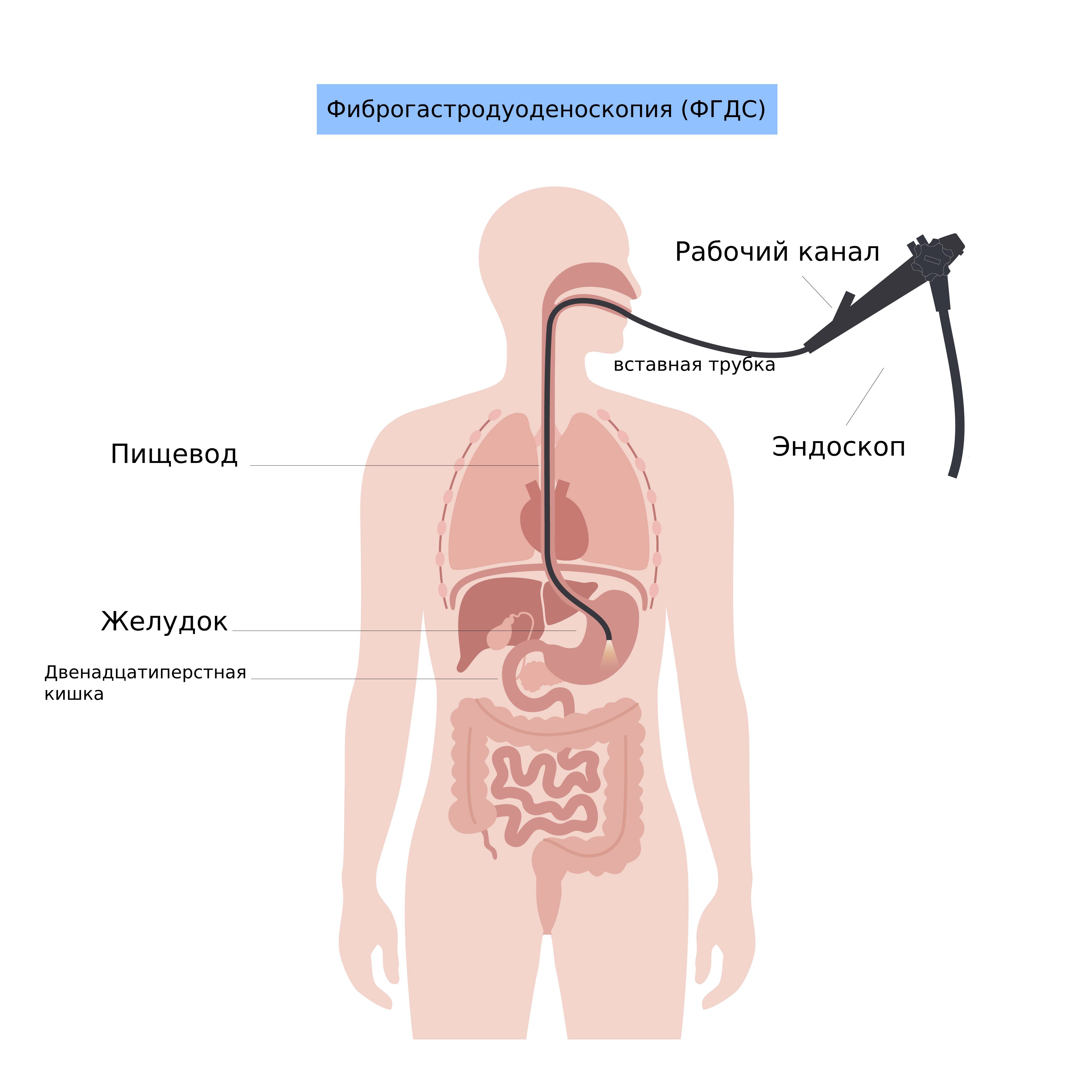 Гастроскопия желудка как проводится