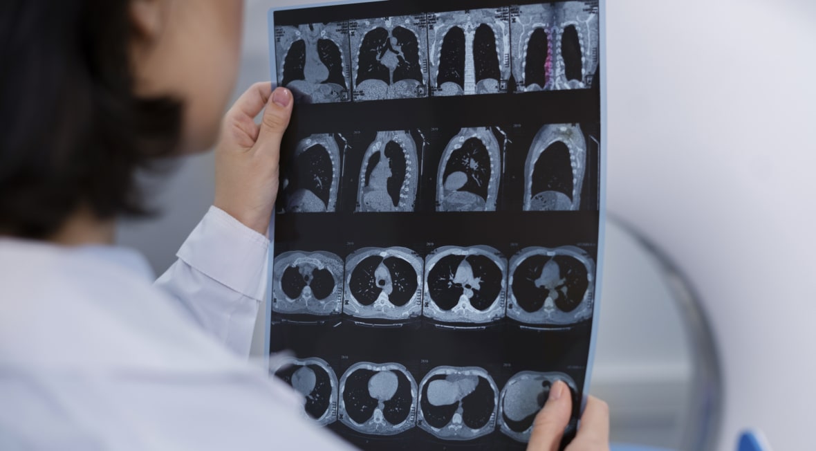 Результаты МРТ исследования