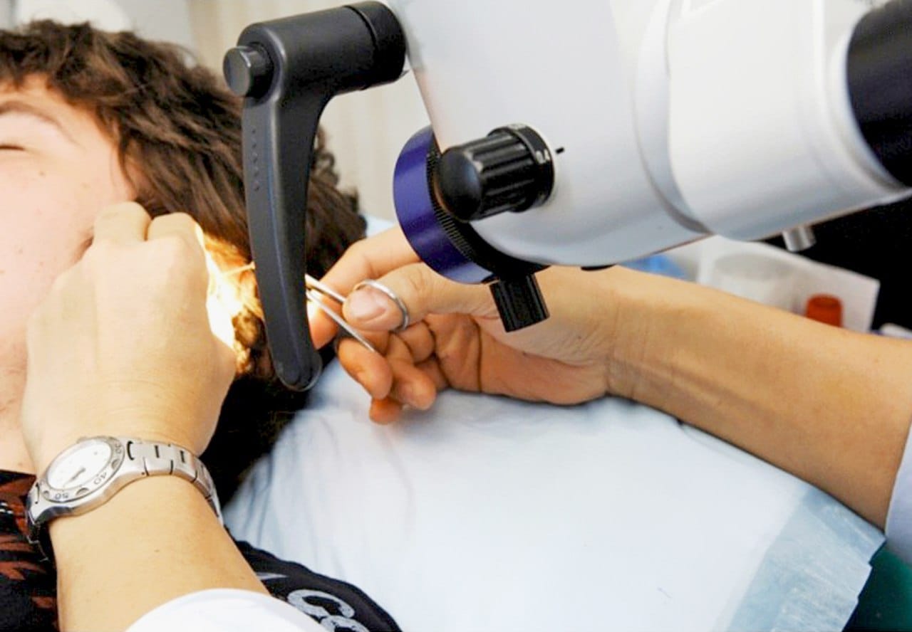 В ФНКЦ ФМБА впервые в России проведена уникальная операция – баллонная пластика слуховой трубы