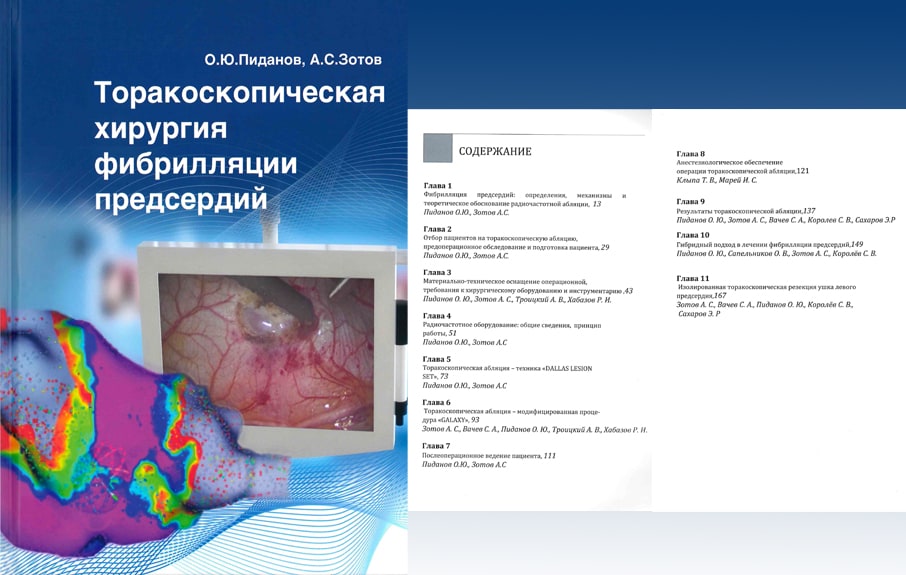 Поздравляем коллег с выходом руководства по торакоскопической абляции фибрилляции предсердий!