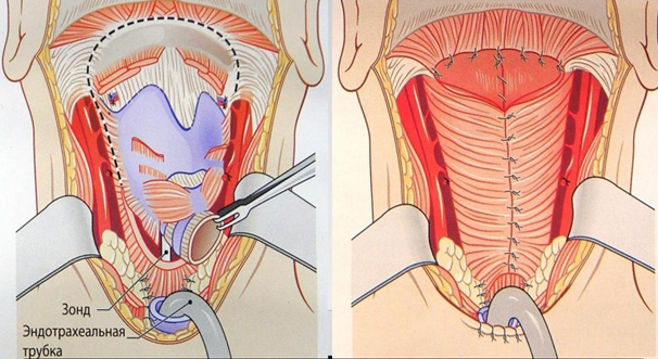 лари_2 лари_2
