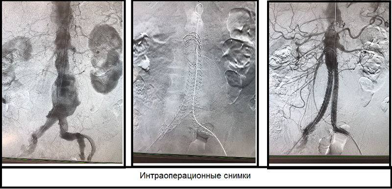 Серия фотографий до и после операции