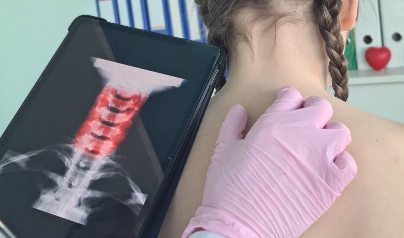 Диагностика аномалии Киммерли Диагностика аномалии Киммерли