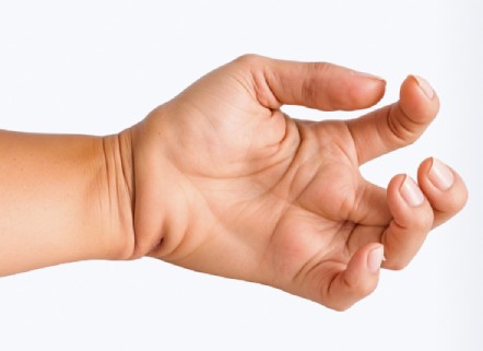 Диагностика спастичности