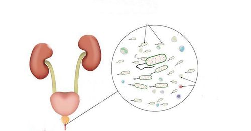 Уретрит симптомы Уретрит симптомы