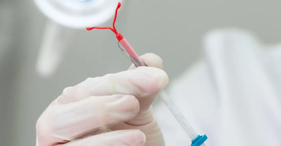 ВМС установка и удаление