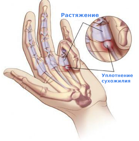 Щелкающий палец