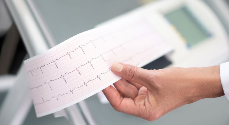 Тахикардия симптомы