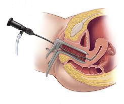 Диагностика рака матки