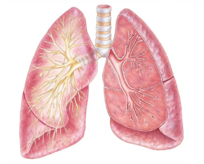 Интерстициальное поражение легких
