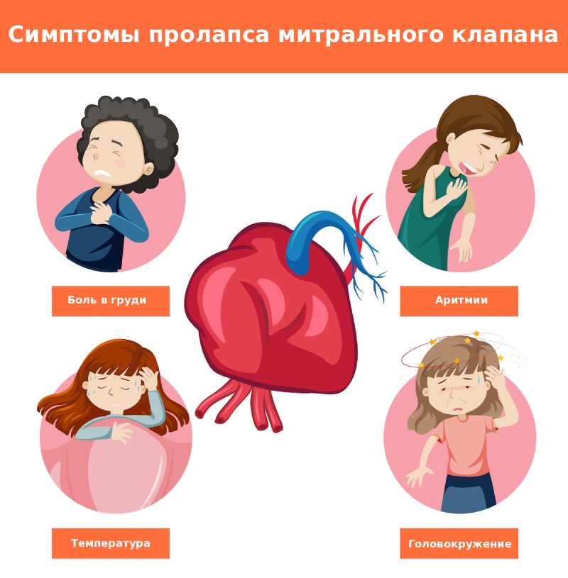 Симптомы пролапса минтрального канала