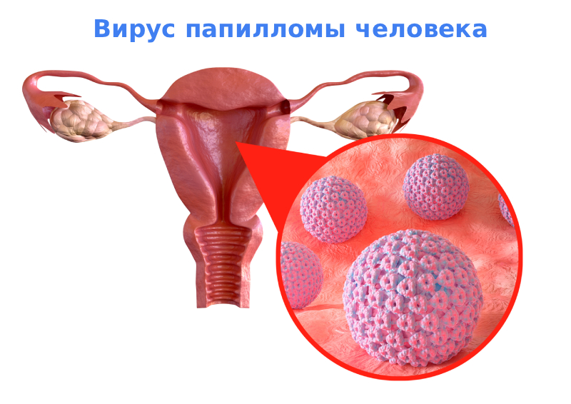 Причины дисплазии