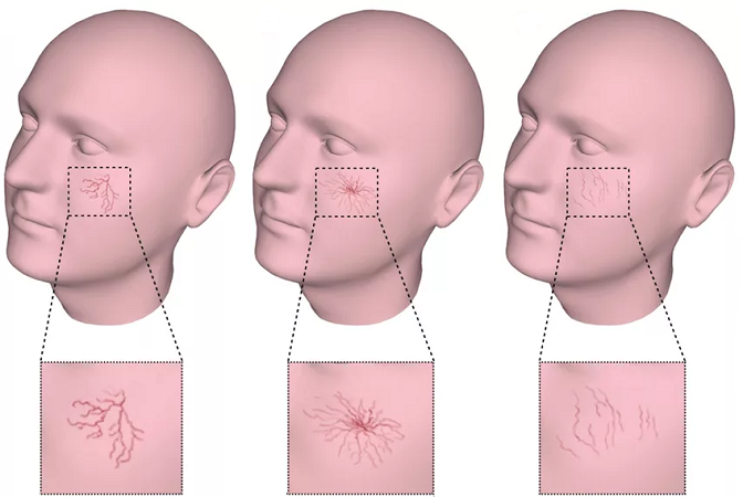Купероз Купероз