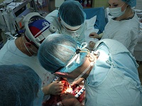 Команда кардиохирургов выполняет реконструктивную операцию на корне аорты