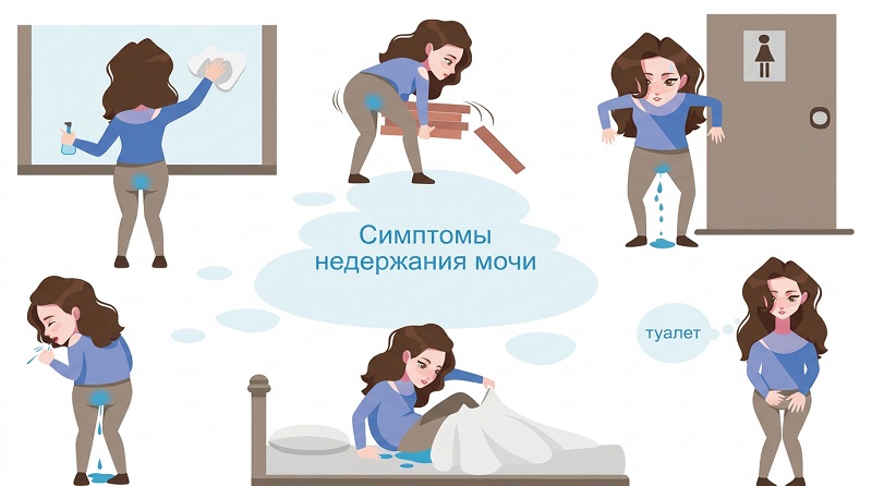 Недержание мочи у женщин причины и лечение Недержание мочи у женщин причины и лечение